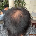 Cứu được không các bro??